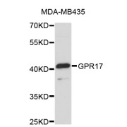 Western blot analysis of extracts of MDA-MB-435 cells, using GPR17 antibody (abx002838).