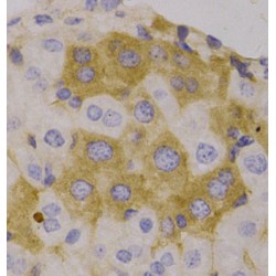 Next To BRCA1 Gene 1 Protein (NBR1) Antibody