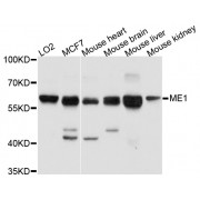 Western blot analysis of extracts of various cell lines, using ME1 antibody (abx002894) at 1/1000 dilution.