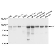 Western blot analysis of extracts of LO2, HeLa, BT-474, 22Rv1 cell lysates, Mouse liver, kidney, heart, pancreas and Rat liver tissues (25 µg per lane), using Methylmalonyl-CoA Mutase, Mitochondrial (MUT) Antibody (1/1000 dilution), followed by <a href="https://www.abbexa.com/index.php?route=product/search&search=abx005548" target="_blank">abx005548</a> - Goat Anti-Rabbit IgG, H+L (1/10000 dilution) and 3% non-fat dry milk in TBST for blocking.