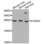 Western blot analysis of extracts of various cell lines, using S100A3 antibody (abx003019) at 1/1000 dilution.