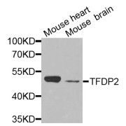 Western blot analysis of extracts of various cell lines, using TFDP2 antibody (abx003066) at 1/1000 dilution.