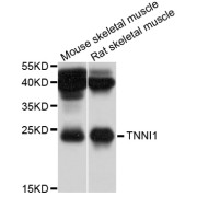 Western blot analysis of extracts of various cell lines, using TNNI1 antibody (abx003074) at 1/1000 dilution.