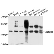 Western blot analysis of extracts of various cell lines, using µgT2B4 antibody (abx003090) at 1/1000 dilution.