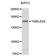 Western blot analysis of extracts of BxPC-3 cells, using TIMELESS antibody (abx003158) at 1:3000 dilution.