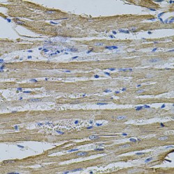 Eukaryotic Translation Initiation Factor 1A, Y-Chromosomal (EIF1AY) Antibody