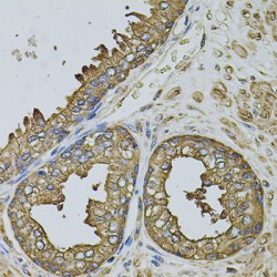 Eukaryotic Translation Initiation Factor 1A, Y-Chromosomal (EIF1AY) Antibody