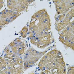 Eukaryotic Translation Initiation Factor 1A, Y-Chromosomal (EIF1AY) Antibody