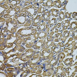 Eukaryotic Translation Initiation Factor 1A, Y-Chromosomal (EIF1AY) Antibody