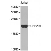 Western blot analysis of extracts of Jurkat cells, using UBE2L6 antibody (abx003178).