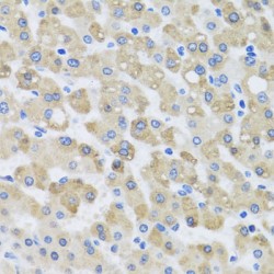 Synaptosomal-Associated Protein 29 (SNAP29) Antibody