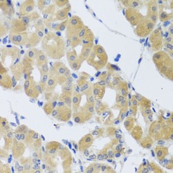 Synaptosomal-Associated Protein 29 (SNAP29) Antibody