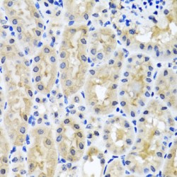 Synaptosomal-Associated Protein 29 (SNAP29) Antibody