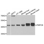 Western blot analysis of extracts of various cell lines, using PMPCB antibody (abx003204) at 1/1000 dilution.