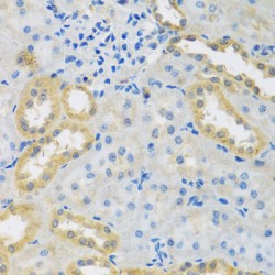 Peptidase, Mitochondrial Processing Beta Subunit (PMPCB) Antibody