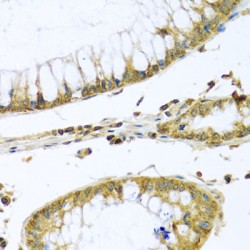 Peptidase, Mitochondrial Processing Beta Subunit (PMPCB) Antibody