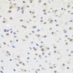 Scaffold Attachment Factor B2 (SAFB2) Antibody