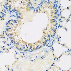 ATP Binding Cassette Subfamily F Member 2 (ABCF2) Antibody