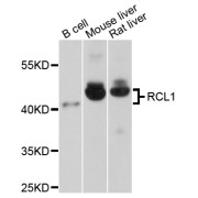 Western blot analysis of extracts of various cell lines, using RCL1 antibody (abx003266) at 1/1000 dilution.