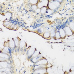 Cartilage Associated Protein (CRTAP) Antibody