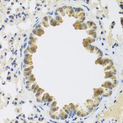 Cartilage Associated Protein (CRTAP) Antibody