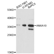 Western blot analysis of extracts of various cell lines, using ANXA10 antibody (abx003363) at 1:3000 dilution.