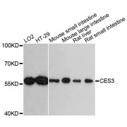 Western blot analysis of extracts of various cell lines, using CES3 antibody (abx003421) at 1:3000 dilution.