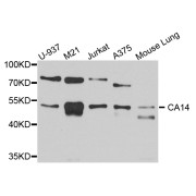 Western blot analysis of extracts of various cell lines, using CA14 antibody (abx003435) at 1/1000 dilution.