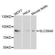 Western blot analysis of extracts of various cell lines, using SLC39A6 antibody (abx003445) at 1/1000 dilution.