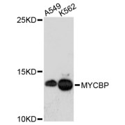 Western blot analysis of extracts of various cell lines, using MYCBP antibody (abx003477) at 1:3000 dilution.