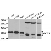 Western blot analysis of extracts of various cell lines, using DCXR antibody (abx003567) at 1/1000 dilution.