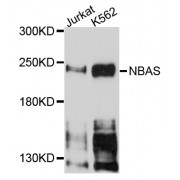 Western blot analysis of extracts of various cell lines, using NBAS antibody (abx003586) at 1/1000 dilution.