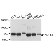 Western blot analysis of extracts of various cell lines, using NOP58 antibody (abx003587) at 1/1000 dilution.