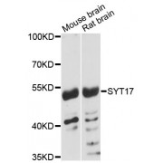 Western blot analysis of extracts of various cell lines, using SYT17 antibody (abx003601) at 1:3000 dilution.