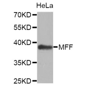 Western blot analysis of extracts of HeLa cells, using MFF antibody (abx003698).