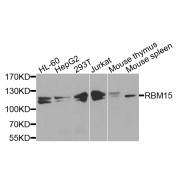 Western blot analysis of extracts of various cell lines, using RBM15 antibody (abx003755) at 1/1000 dilution.