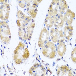 Mitochondrial Ribosomal Protein L11 (MRPL11) Antibody