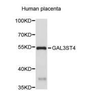 Western blot analysis of extracts of human placenta, using GAL3ST4 antibody (abx003796).