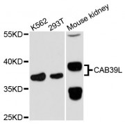 Western blot analysis of extracts of various cell lines, using CAB39L antibody (abx003831) at 1:3000 dilution.