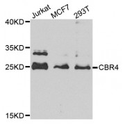 Western blot analysis of extracts of various cell lines, using CBR4 antibody (abx003873) at 1/1000 dilution.