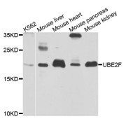 Western blot analysis of extracts of various cell lines, using UBE2F antibody (abx003953) at 1/1000 dilution.