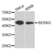 Western blot analysis of extracts of various cell lines, using SESN3 antibody (abx003957) at 1/1000 dilution.