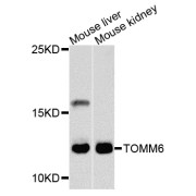 Western blot analysis of extracts of various cell lines, using TOMM6 antibody (abx004026) at 1/1000 dilution.