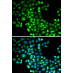 Forkhead Box Protein P1 (FOXP1) Antibody