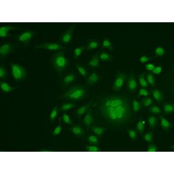 DNA Excision Repair Protein ERCC-1 (ERCC1) Antibody