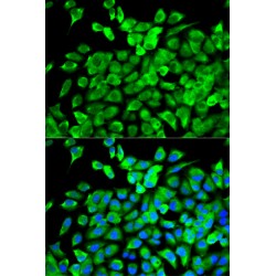 Eukaryotic Translation Initiation Factor 4A1 (EIF4A1) Antibody