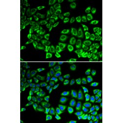 Aminoacyl tRNA Synthetase Complex Interacting Multifunctional Protein 1 (AIMP1) Antibody