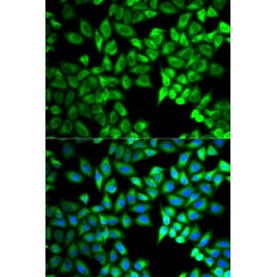 Twinkle Protein, Mitochondrial (C10orf2) Antibody