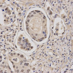 Core-Binding Factor Subunit Beta (CBFB) Antibody