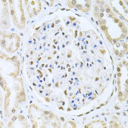 Core-Binding Factor Subunit Beta (CBFB) Antibody